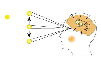 brain injury thumbnail.jpg